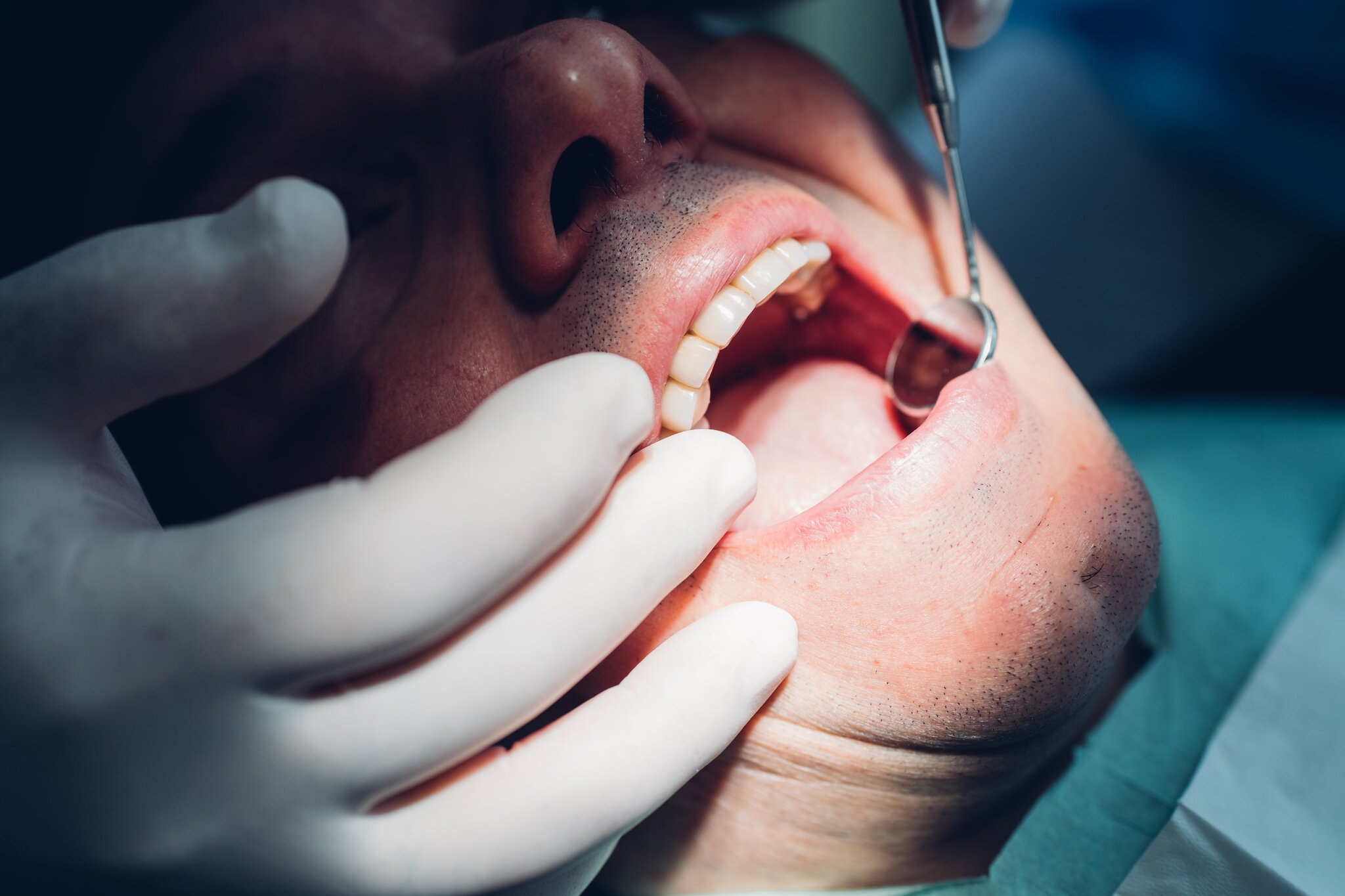 Dentista utilizando cámara dental 3D para escanear dientes con una paciente en la clínica de Catarroja Dental